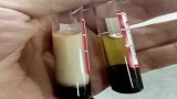 广东肇庆：一顿海鲜大餐后，38岁男子抽出“酸奶血”