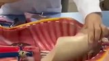 医学生拼身体器官，至少都在肚子里