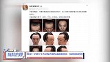 辟谣！华晨宇工作室发声明否认植发整容，并上告造谣者