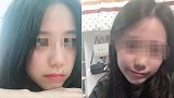 被裸照威胁轻生女孩捐献器官救5人：2人已重获光明