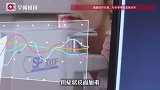男子长针眼当痘挤，脓液入眼险失明，医生：再晚点眼睛会“报废”