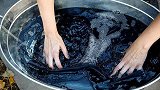 男子双手发黑以为患血栓 医生：裤子掉色了