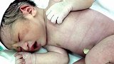 太奇妙了！刚出生2分钟的婴儿皮肤薄如蝉翼，很脆弱也很美丽