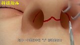 3D动画模拟隆鼻手术全过程，看完你还敢去整容吗？