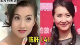 15位不整容的女星今昔对比，美了大半辈子，优雅从容地老去