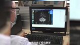 多看一眼救下一条命！浙江女子饭店吃饭被陌生男子提醒患病