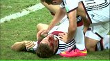 世界杯-14年-《巴西快线》：穆勒赛中受伤鲜血满面-新闻