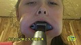 美国14岁少女为追星将锤子塞进嘴里 照片遭疯传