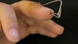 贵阳女子扔垃圾 扔断手指
