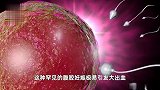 罕见！受精卵“出逃”钻进了女子的腹腔，武汉专家紧急出手