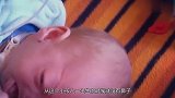 现实版伏地魔，婴儿天生没有鼻子，父母竟不急着做手术