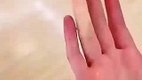 手指突然失去血色，有可能是雷诺现象，建议马上去医院检查