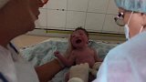 给新生儿剪脐带，宝宝死死的盯着医生：你小心点，我记住你了