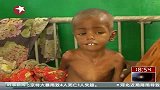 索马里饥荒蔓延 安理会呼吁紧急援助