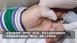 可怕！上海一男子吃变质腌制食品，全身和血液都变成了蓝黑色