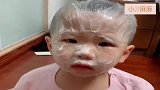 宝宝：你快过来看看，我这脸怎么了！