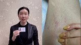 女子举报开封交警一副支队长家暴 纪委：已停职接受调查