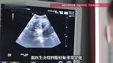 女子多年不孕一次性怀上四胞胎，却要忍痛减去三胎，医生回应