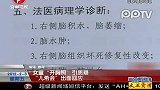 女童开胸照罩引质疑 儿希会出面回应