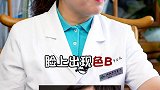 25-30岁女性怎么 护肤？皮肤 护肤 南方健康