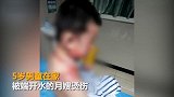 月嫂端开水烫伤男童脸部红肿起泡 家政：月嫂已下线