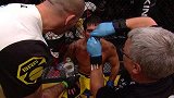 UFC-16年-UFC200副赛：雏量级迪拉肖vs阿松桑-全场