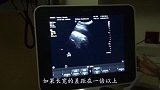 做产检时，医生绝口不提胎儿性别？别急，B超数据一眼看出男女！