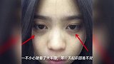 经常“熬夜”玩手机,这3种水果使劲吃,女生:是眼睛的“救星”