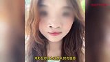 先天性唇腭裂女大学生哭诉遭恶评：因妈妈吃药导致完全无鼻骨
