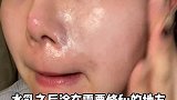 烂脸如果贸然刷犹如火上浇油！ 我历时两个月肉眼可见恢复过程经验分享 ！精简护肤 握住稳稳的幸福！测评