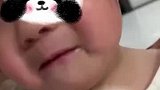妹妹头磕伤缝针，哥哥自责痛哭