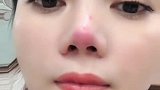 这就是整容的下场，看到小姐姐的鼻子，我都怀疑人生了