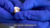 可乐喝多了真的会腐蚀牙齿吗老外亲自实验，网友以后要少喝了