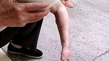 医院治不好的病被大爷治好了