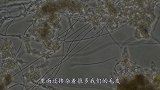 洗澡搓下来的黑泥到底是啥？显微镜放大100倍后，简直辣眼睛！