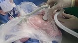 刚出生1分钟的宝宝，没哭声被医生抱走处理，妈妈看不到画面