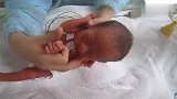 六天大的早产儿，早上醒来是这个样子的，好可爱啊！