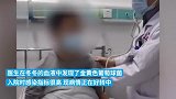 13岁男孩挤痘引发脑膜炎，高烧39.7℃被送医