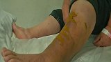 湖北武汉：阿婆买菜回来竟然“中了毒”，更可怕的是