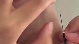 医学生练习扎针，没想手忍不住颤抖