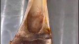 原来骨髓都是这样造假的