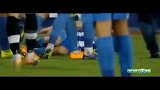 足球-14年-胆小慎入！罗马尼亚又见断腿惨案 小腿折成两截惨不忍睹-花絮