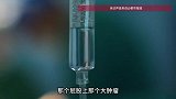 17岁女孩运动后屁股疼，骨盆剥下2斤肿瘤装满一盆，医生提醒