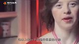 为什么唐氏综合症患者，几乎都长得一模一样原因让人心疼