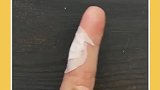 伤口处理小窍门来了，看完视频的你学会了吗？快去试试吧