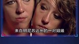 7种罕见的畸形人