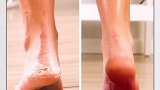 关于脚丫的几个小妙招，你一定不知道！