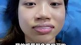 女子做唇色矫正，中途突然变成香肠嘴