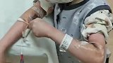 男孩接受骨髓移植后自己拿棉签消毒