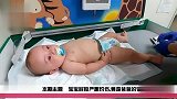 育儿：宝宝屁股严重灼伤，竟是爸爸的无知变态行为造成的